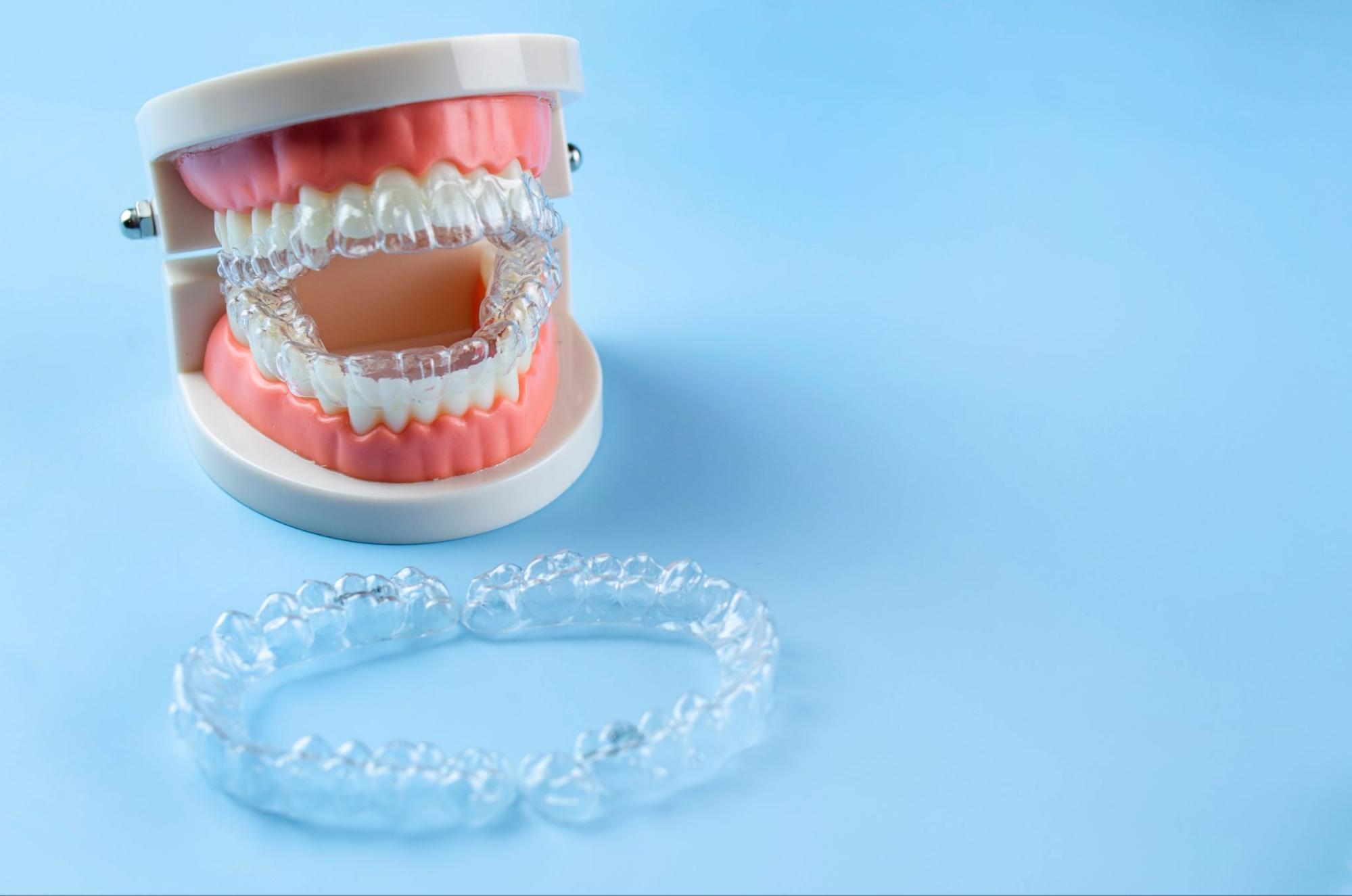 How Invisalign Technology Works